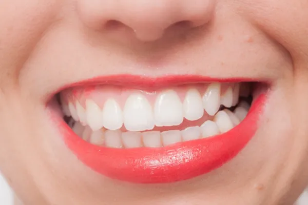 食いしばり・歯ぎしりへの生活習慣アプローチ