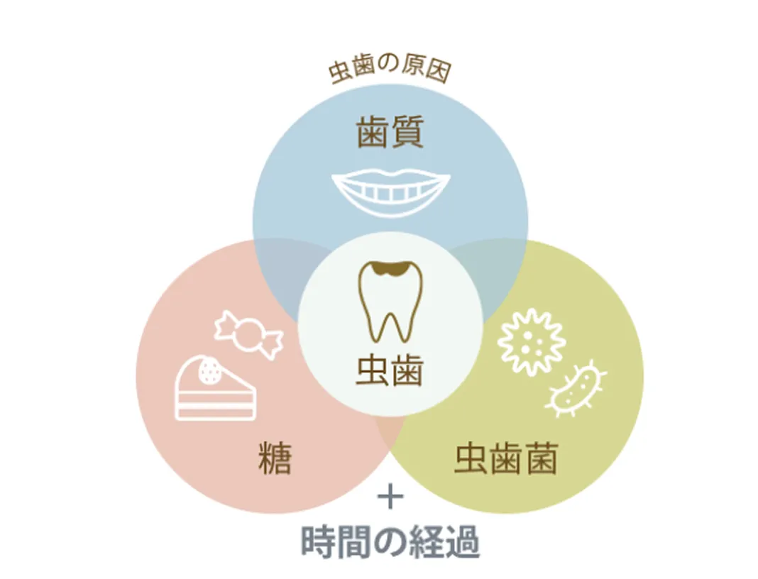 虫歯の原因とは？